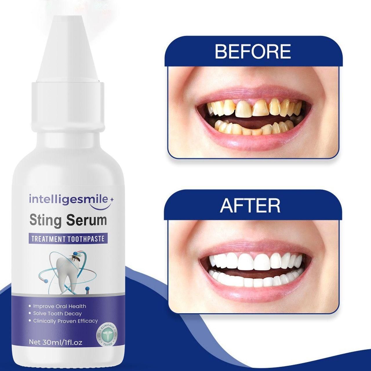 Intelligesmile Sting Serum Treatment Toothpaste